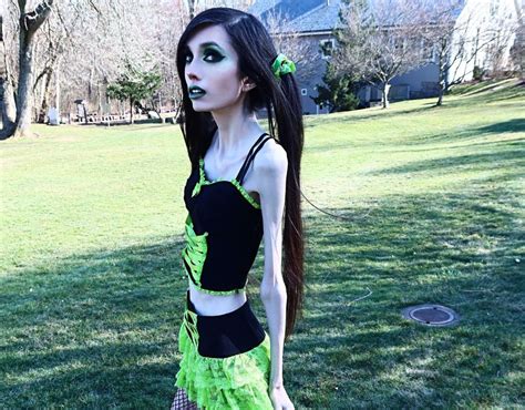 Eugenia Cooney Before After Health Update Now Weight Height
