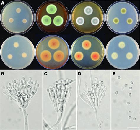 Colonial And Microscopic Morphology Of Talaromyces Xishaensis Hmas