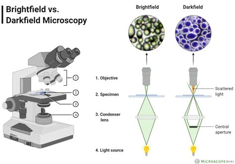 Difference Between Brightfield And Darkfield Microscope Microscope Wiki