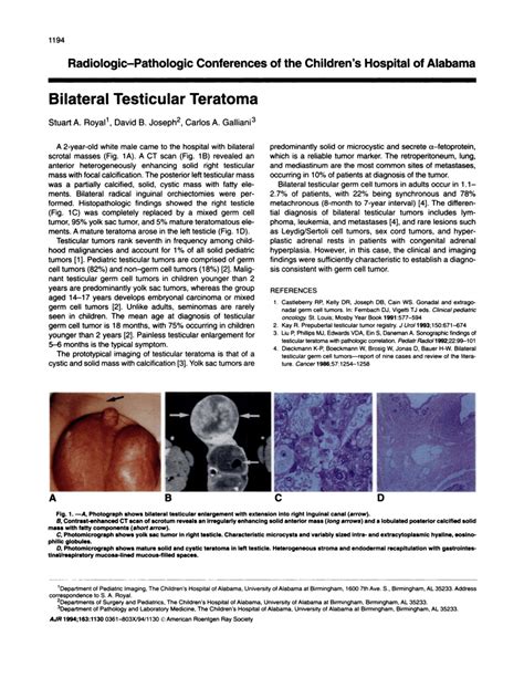 Pdf Bilateral Testicular Teratoma