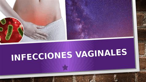 Infecciones Vaginales Diapositivas De Ginecología Docsity