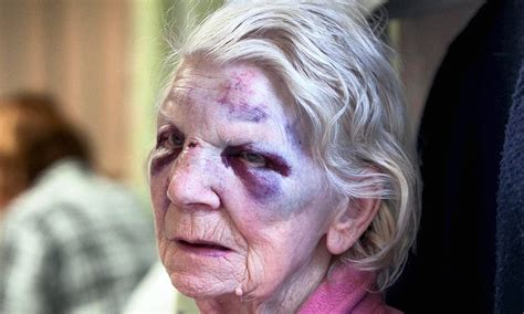 Her career of travelling and writing about her travels has spanned 40 years. Shocking injuries of grandmother, 92, kicked and beaten on ...