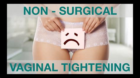 Vagina Tightening Vaginoplasty Non Surgical Treatment Session My Xxx