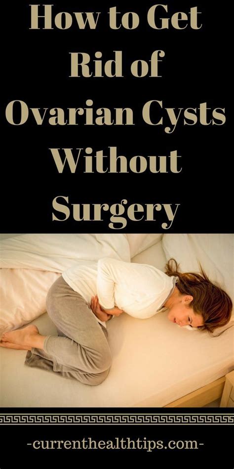 How To Get Rid Of Ovarian Cysts Without Surgery S N Tate