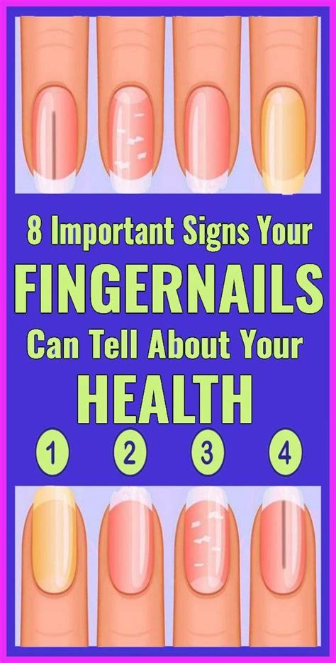 These 8 Significant Signs That Your Fingernails Tell You About Health