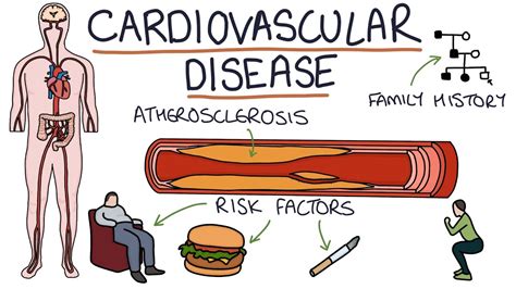 Understanding Cardiovascular Disease Visual Explanation For Babes YouTube