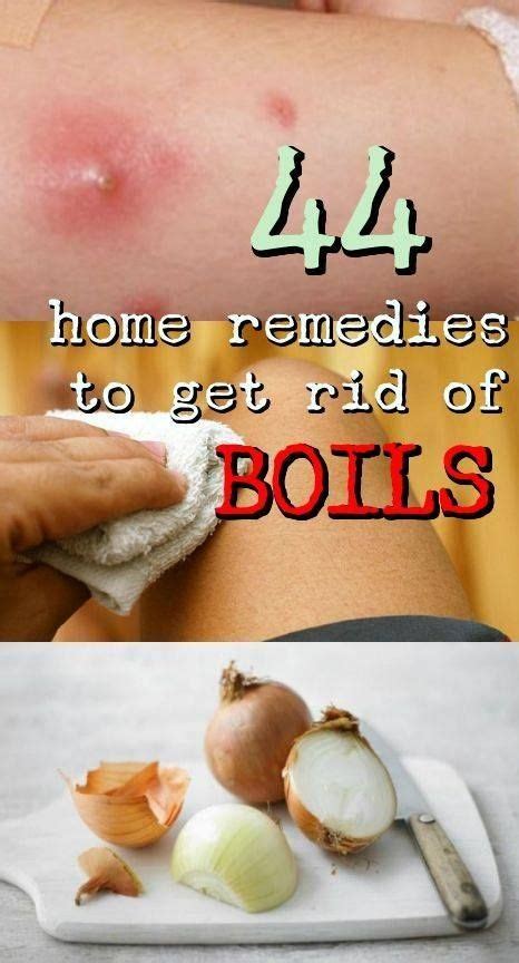 Home Remedies To Get Rid Of Boil Get Rid Of Boils Natural Home