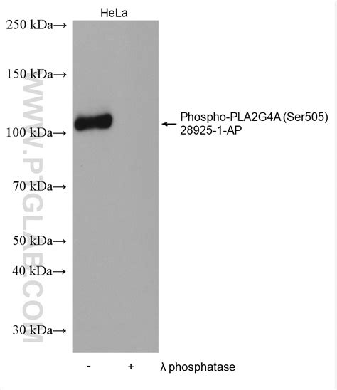 Maybe you would like to learn more about one of these? Phospho-PLA2G4A (Ser505) Antibody 28925-1-AP | Proteintech