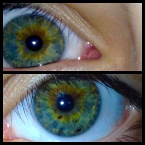 Central Heterochromia On Tumblr Heterochromia Central Heterochromia