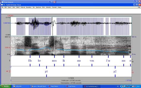 Display Of Speech Waveform Spectrogram And F0 Trace Syllable