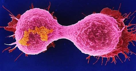 A tumour can become cancerous when these abnormally growing cells spread to other parts of the breast or other parts of the body. All Living Things - Breast Cancer & Biology