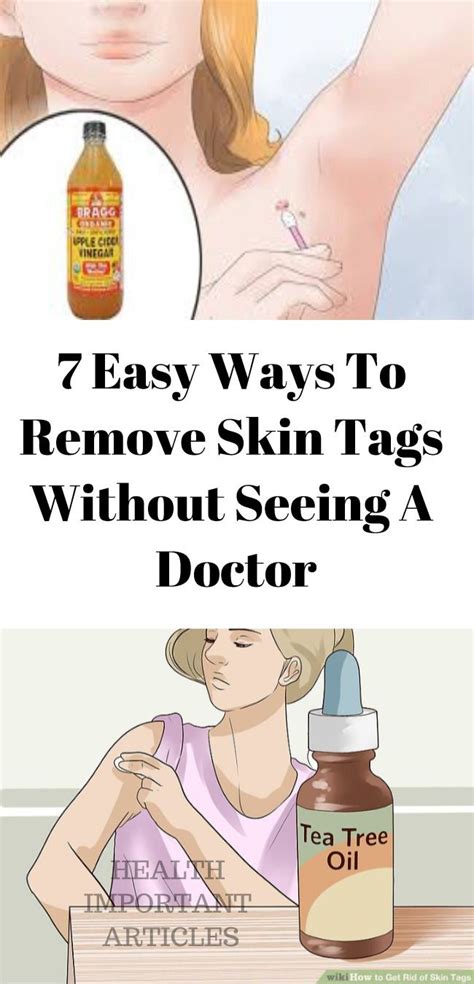 7 easy ways to remove skin tags without seeing a doctor skin tag removal skin tag skin tags