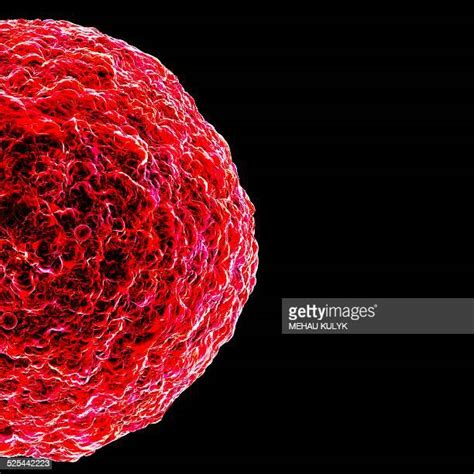 T Cell Leukemia Photos And Premium High Res Pictures Getty Images