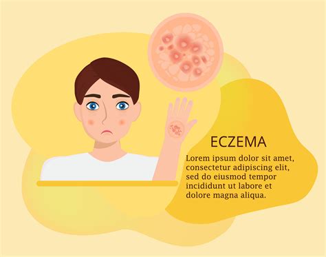 Infographie De Leczéma Avec Raisons Homme Pilules Carte Bactéries
