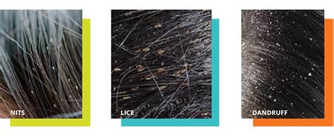 About Head Lice Information For Parents And Schools