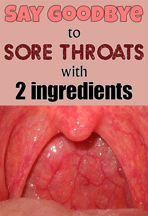 throat sore after throwing up