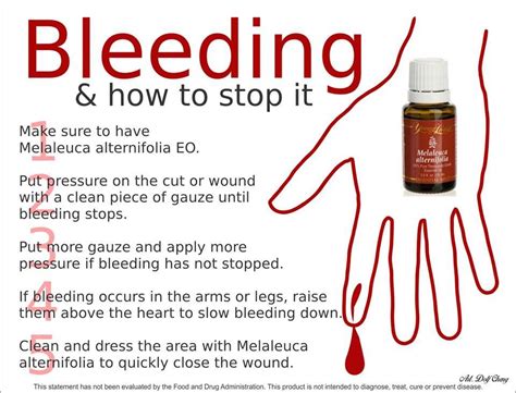 Pin On Nose Bleedbleedingblood Clots