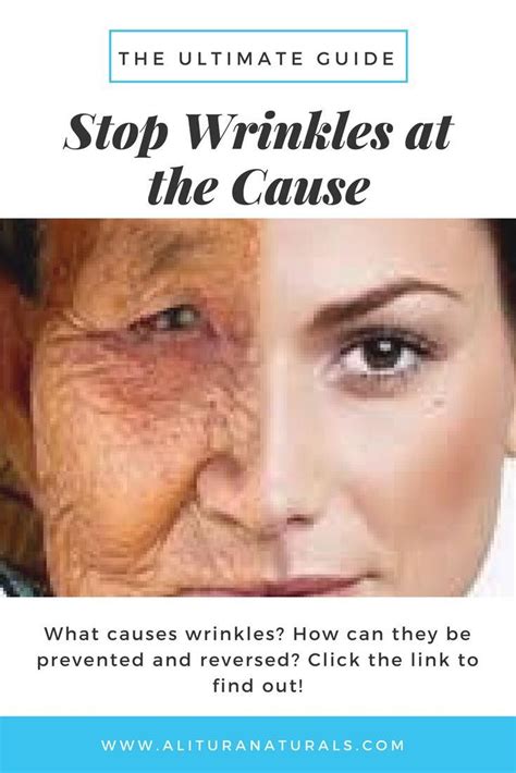 How To Stop Wrinkles At The Cause Face Wrinkles What Causes Wrinkles