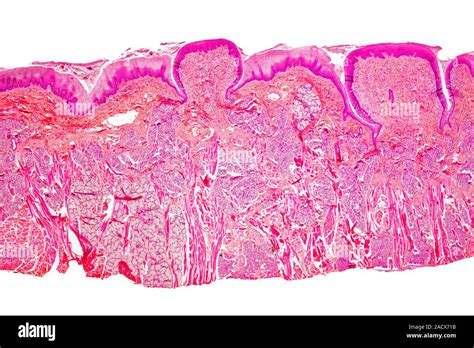 Human Tongue Light Micrograph Of A Transverse Section Through A Human