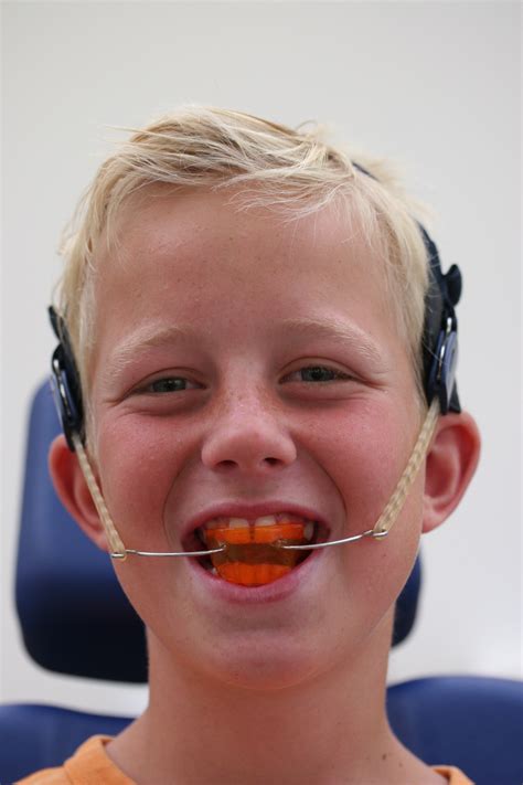 Orthodontiepraktijk Leeuwarden Start Behandeling Orthodontiepraktijk Leeuwarden