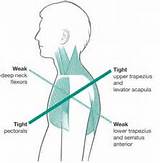 Pictures of Weak Core Muscles Symptoms