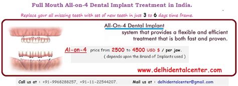 All On 4 Implants Cost In India All On 4 Dental Implants Treatment In