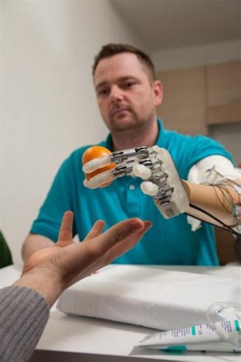In Touch With Reality Scientists Give Amputee Worlds First Prosthetic