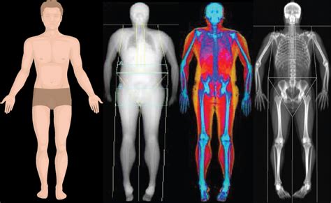 Advanced Body Composition Assessment Cyrus Diagnostic Imaging Inc