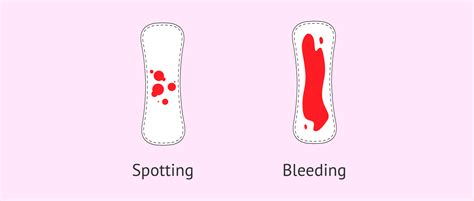 is bleeding in pregnancy normal what are the causes