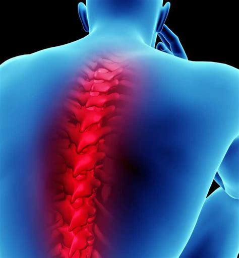 Spinal Cord Injuries Practice Essentials Background A