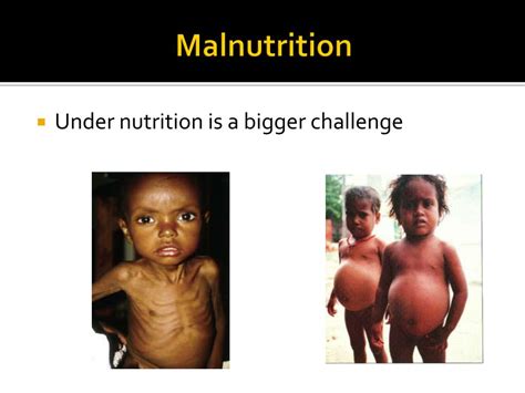 Ppt Importance Of Nutrition In Community Powerpoint Presentation