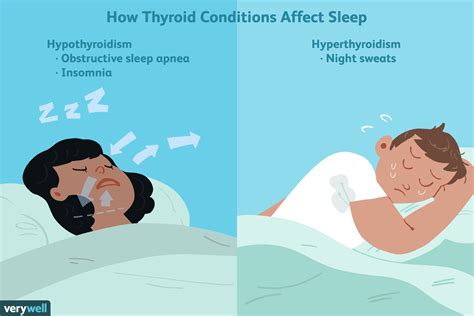 How Can Thyroid Dysfunction Cause Sleep Problems