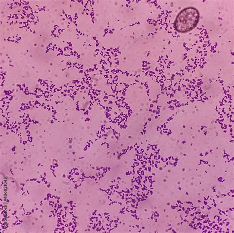 Microscopic View Of Enterococcus Bacteria From Uti Patient Urine Sample