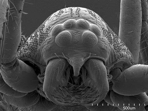 Scorpions Spiders And Sharks Electron Microscope Images
