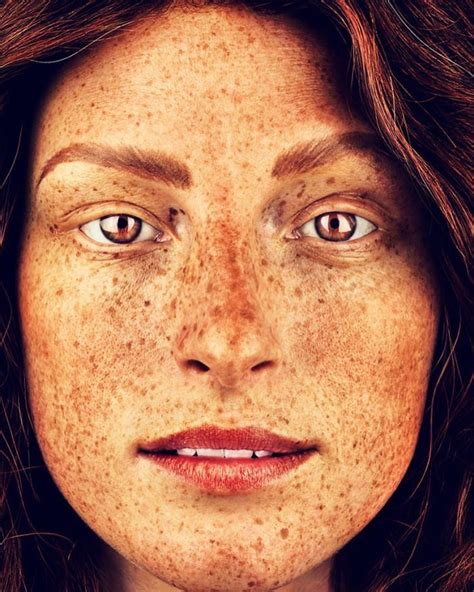 The Beauty Of The Freckles By The Photographer Brock Elbank Beautiful