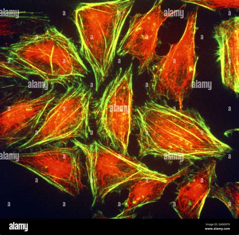 Hela Cells Coloured Immunofluorescent Light Micrograph Lm Of Hela