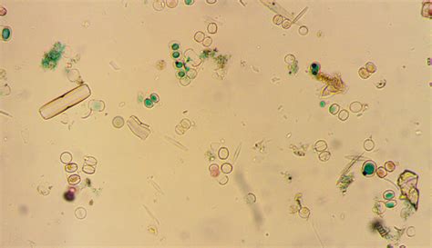 Check spelling or type a new query. Diatoms Under Microscope 100x - Micropedia