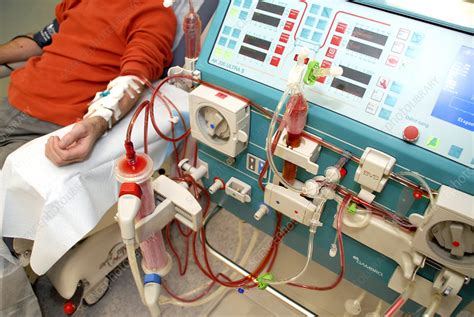 Dialysis is primarily used to provide an artificial replacement for lost kidney function (renal replacement therapy) due to renal failure. Dialysis machine - Stock Image - M495/0132 - Science Photo ...