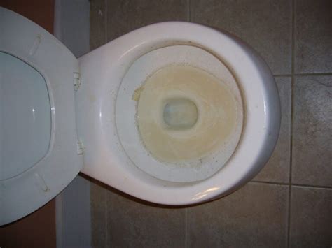 What Is This White Stuff Growing In Toilet Bowl