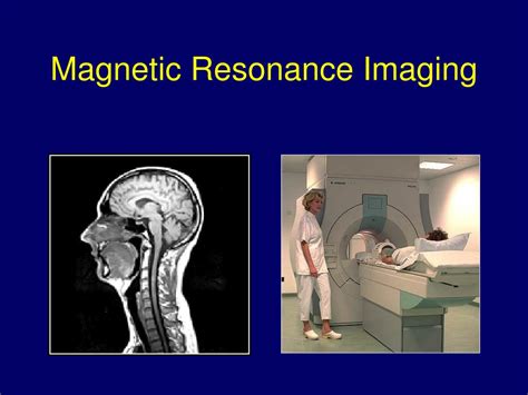 Ppt Magnetic Resonance Imaging Powerpoint Presentation Free Download