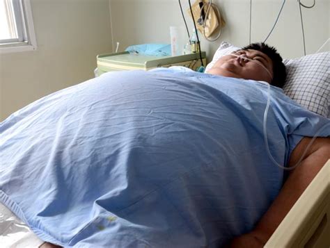 Fatal Obesity Case Sets The Alarm Bells Ringingsociety