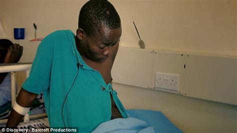 Kenyan Man Has 11lb Testicles Reduced So He Can Walk Daily Mail Online