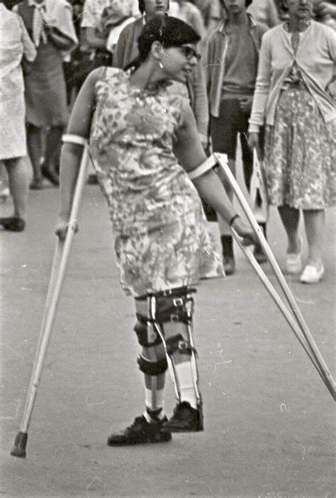 Pin By Elna On Braces Leg Braces Braces Girls Wheelchair Women