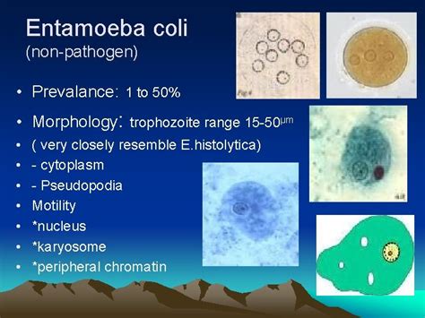 kingdom protista classification of protozoa phylum protozoa subk