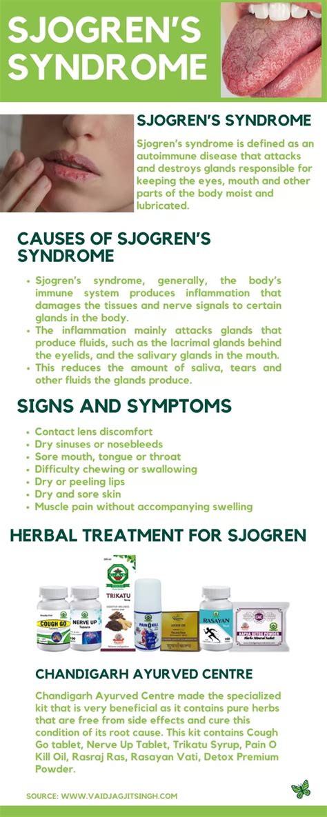 Ppt Sjogrens Syndrome Causes Symptoms And Herbal Treatment
