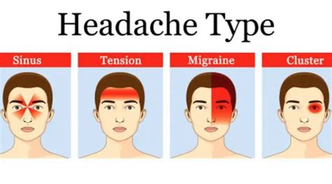 Types Of Headaches And Symptoms Chart