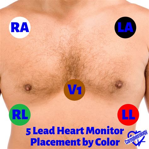 Cardiac Monitor 5 Lead Telemetry Placement
