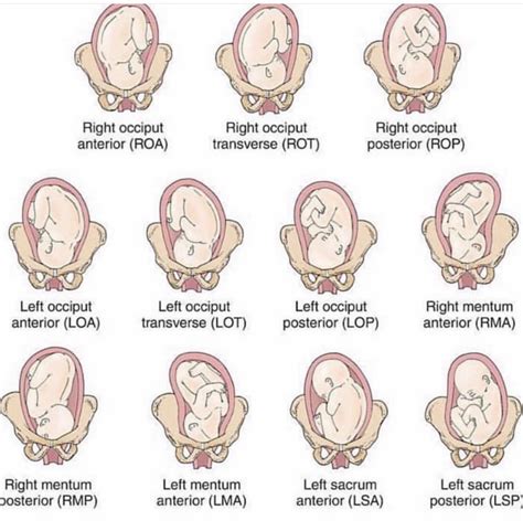 Understanding Fetal Positioning Earthbound Integrative Therapeutics