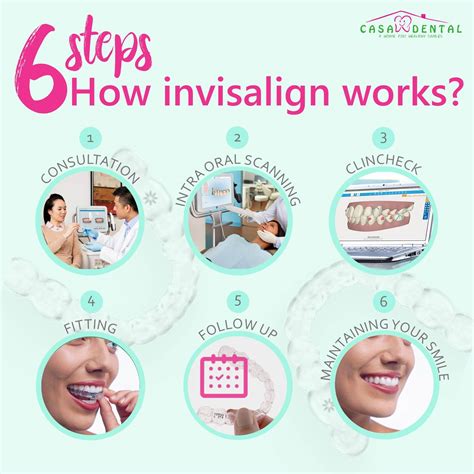 6 Steps On How Invisalign Works And What The Benefits Are