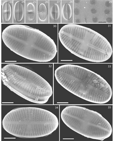 Image Pspennorill Species Diatoms Of North America